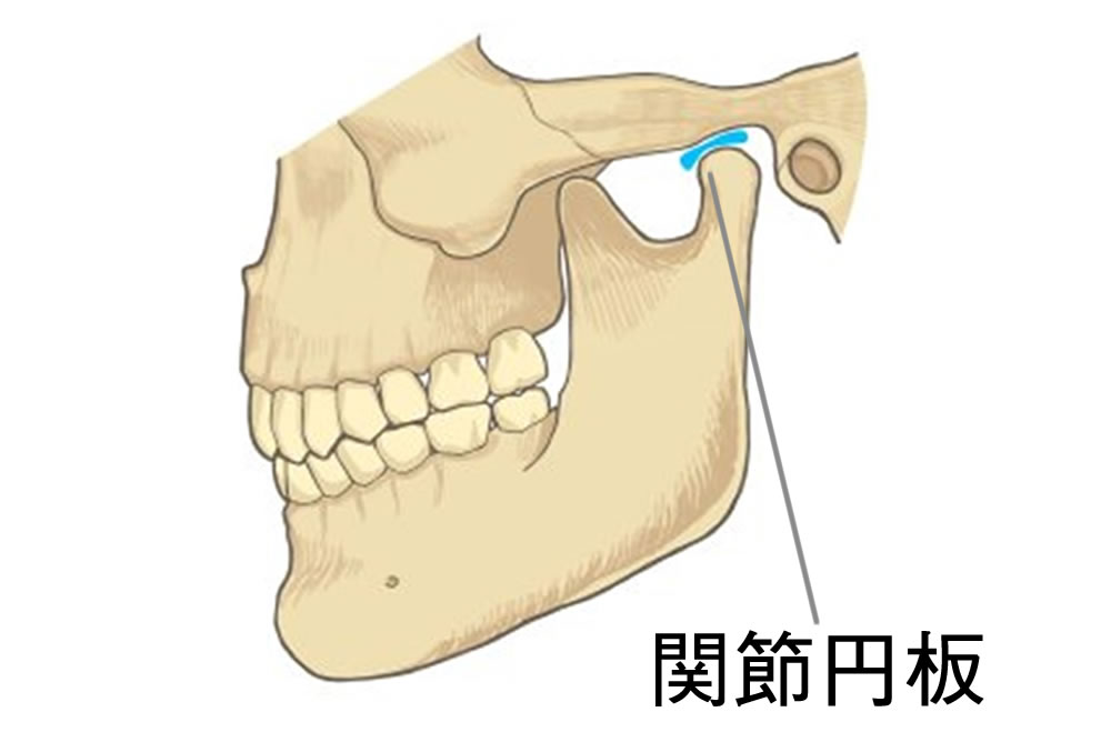 開口障害